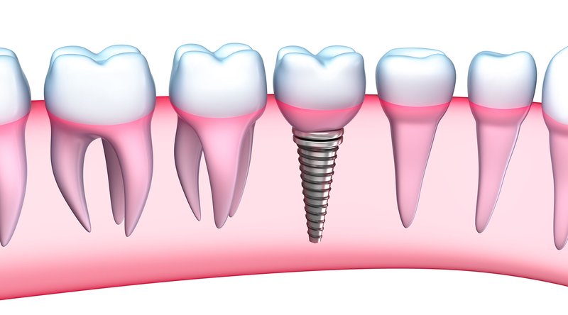 Ada Ideal Dent - Clinica stomatologica